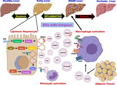 Extracellular Vesicles as Inflammatory Drivers in NAFLD